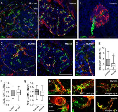 Functional Characterization of the Human Islet Microvasculature Using Living Pancreas Slices